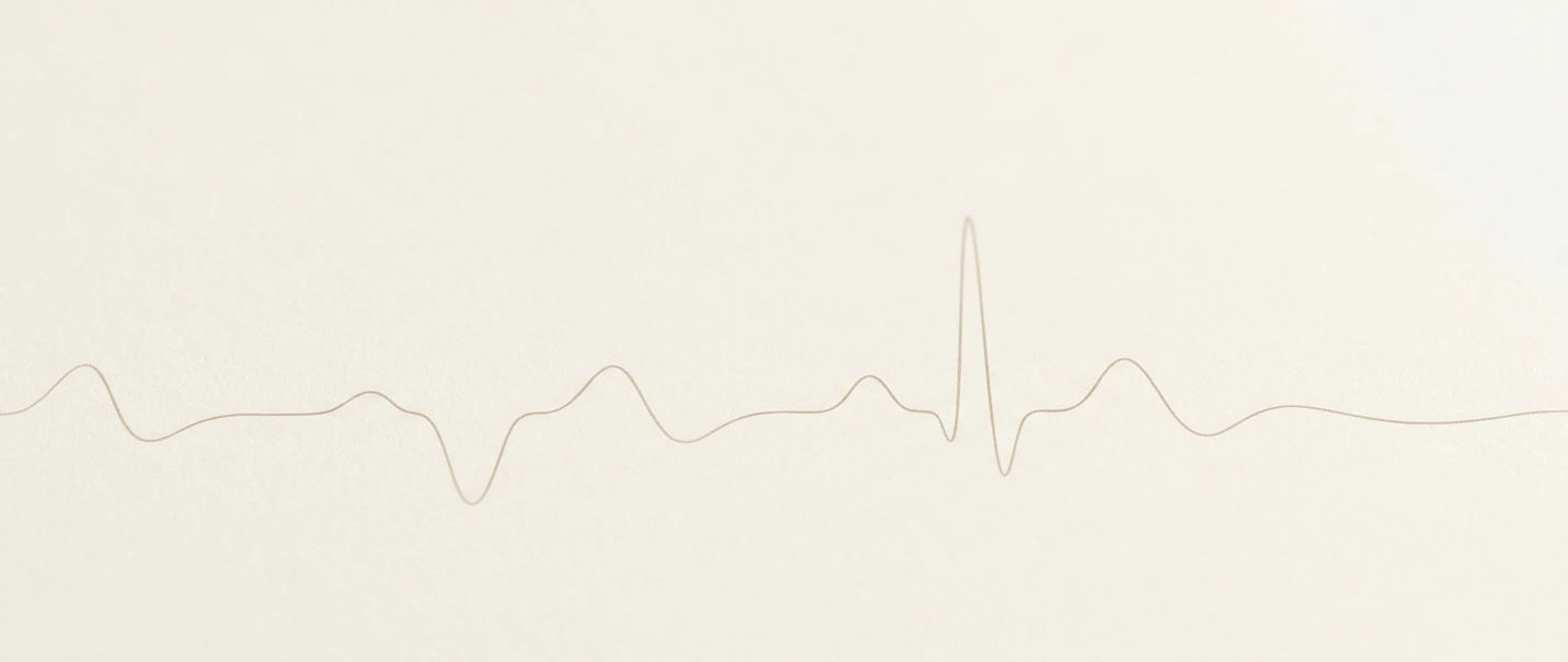 Trazado de electrocardiograma, representación de las palpitaciones cardíacas